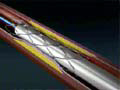 F2